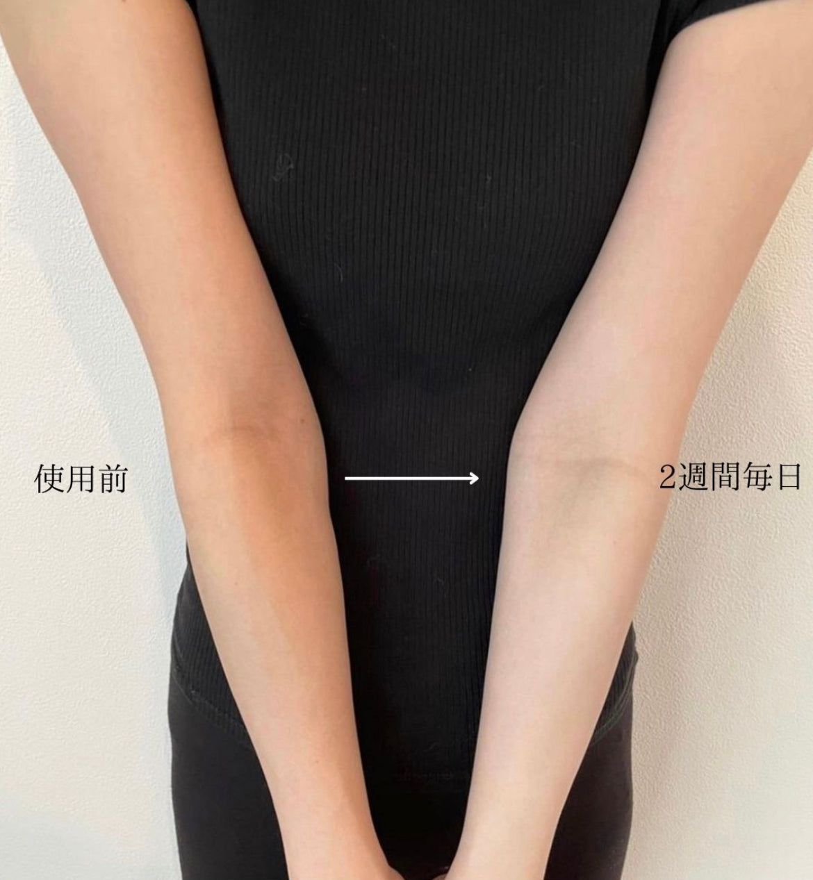 BEBEAURA美白ボディトリートメント